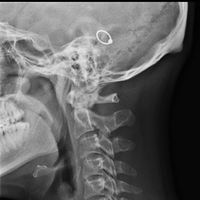 David Cunningham的照片