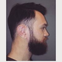 Anes Tojaga的照片