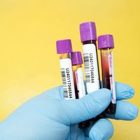 Фотографии пользователя Full Body Health Checkup  in Bhopal