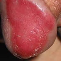 joker banting's Photo