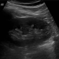 Shaul Marmari的照片