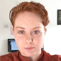 Fotos de Áilish Kerr