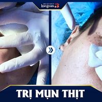 Căng da Làm chết người's Photo