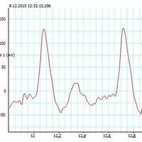 Ane-Mary Arčan的照片