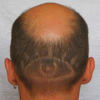 Vladimir Glazunov的照片