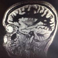 Audrey Sousa Alves's Photo