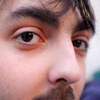 Raphaël Forment's Photo